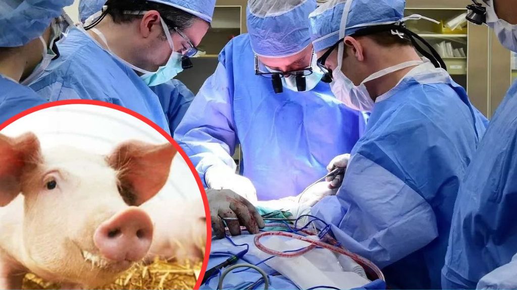 अमेरिका के डॉक्टरों  ने एक बार फिर सूअर की किडनी लगाकर महिला की 