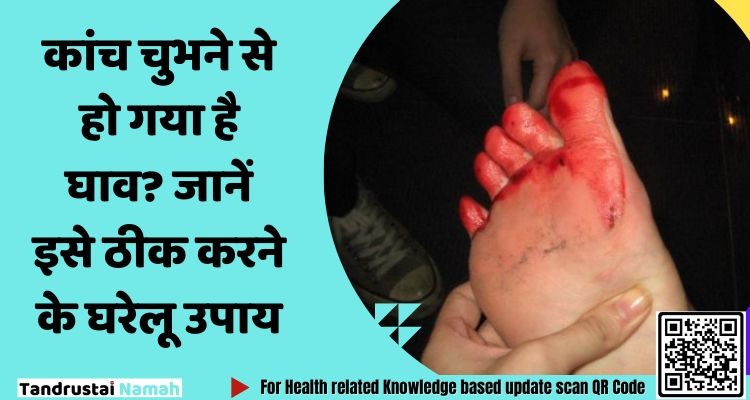 कांच चुभने से हो गया है घाव?