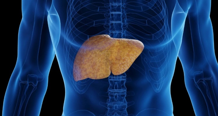 Fatty Liver Symptoms : फैटी लिवर खराब खानपान और लाइफ