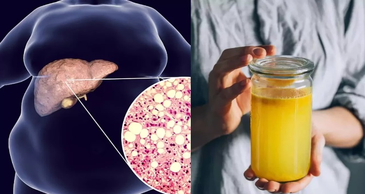 Turmeric Drink Fatty Liver : मात्र 15 घंटे में लिवर को पूरी तरह साफ 