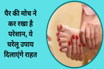 पैर की मोच ने कर रखा है परेशान, 
