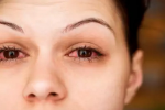 मानसून में तेजी से फैल रहा Eye Flu